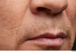 HD Face Skin Steve Q bearded face lips mouth scar…